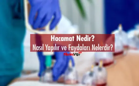 Hacamat Nedir? Nasıl Yapılır ve Faydaları Nelerdir?