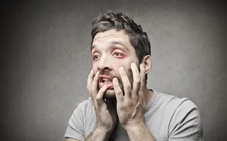 Ağladıktan Sonra Şişen Göz Nasıl Normale Döner?